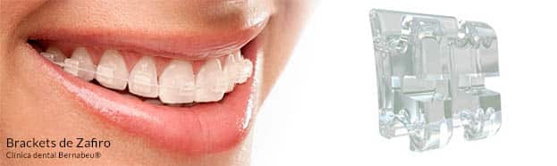 Precio de ortodoncia de zafiro