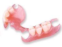 Prótesis dental sobre encía