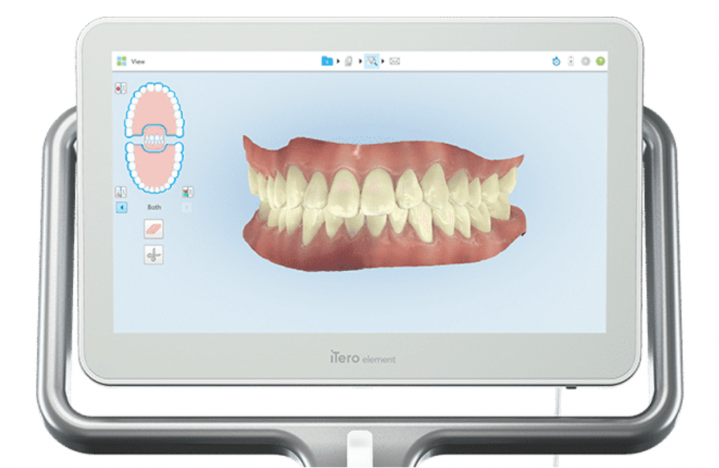 Innovación y actualización continua en la clínica dental en Madrid