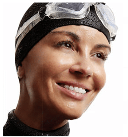 Mujer con una sonrisa tras usar bracketstransparentes en Madrid