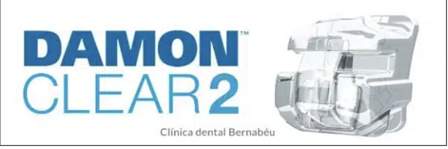 Tratamiento con ortodoncia con sistema Damon Clear 2 en Madrid