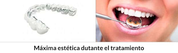 Aparatos dentales Metálicos