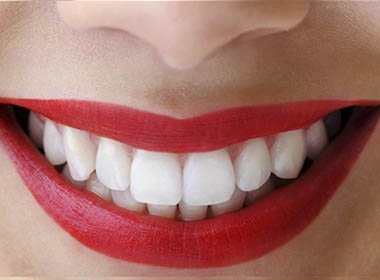 Blanqueamiento Dental ZOOM! de Philips (en clínica)
