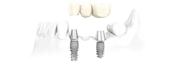 Franquicias y cadenas de clinicas dentales