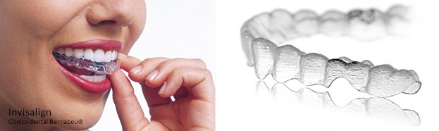 Ortodoncia removible y transparente Invisalign ®
